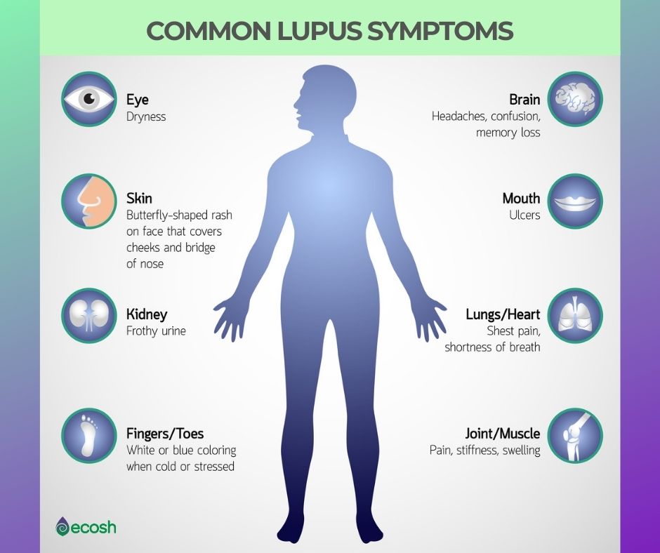 Ecosh_Common_Lupus_Symptoms