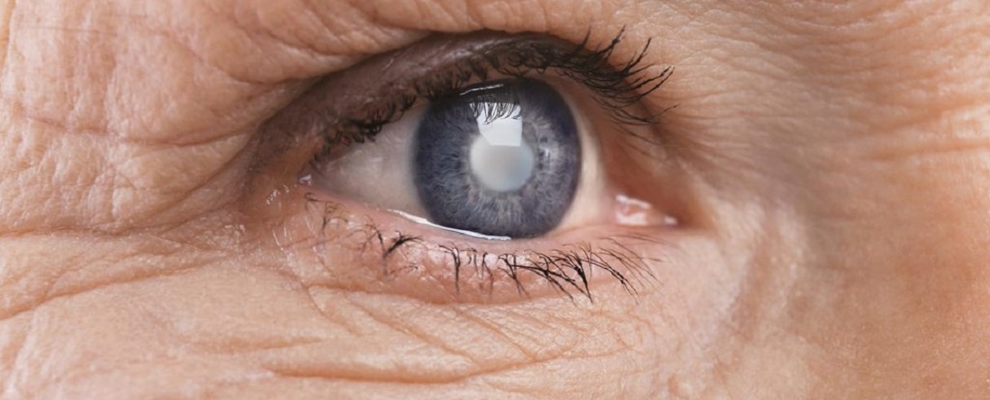 Healthy_Eyes_Eye_Vitamins_Cataract