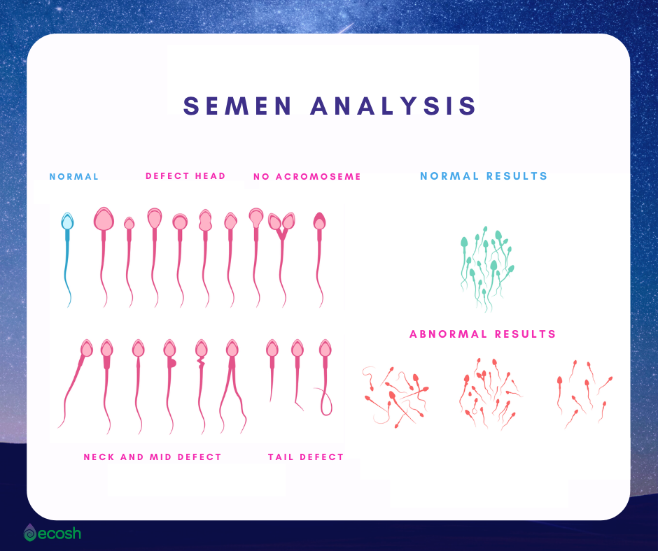 can psoriasis cause male infertility)