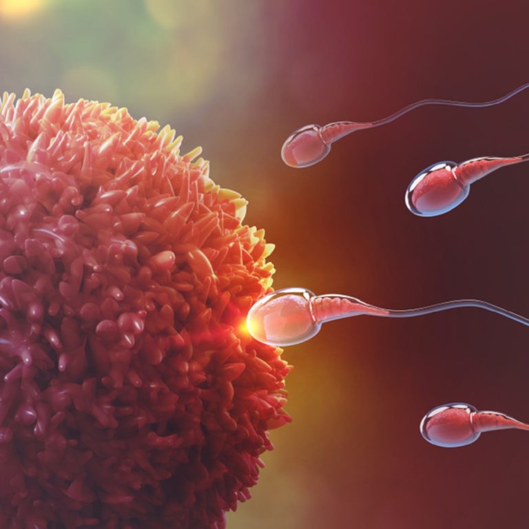 INFERTILITY – Risk Factors and Causes of Male and Female Infertility