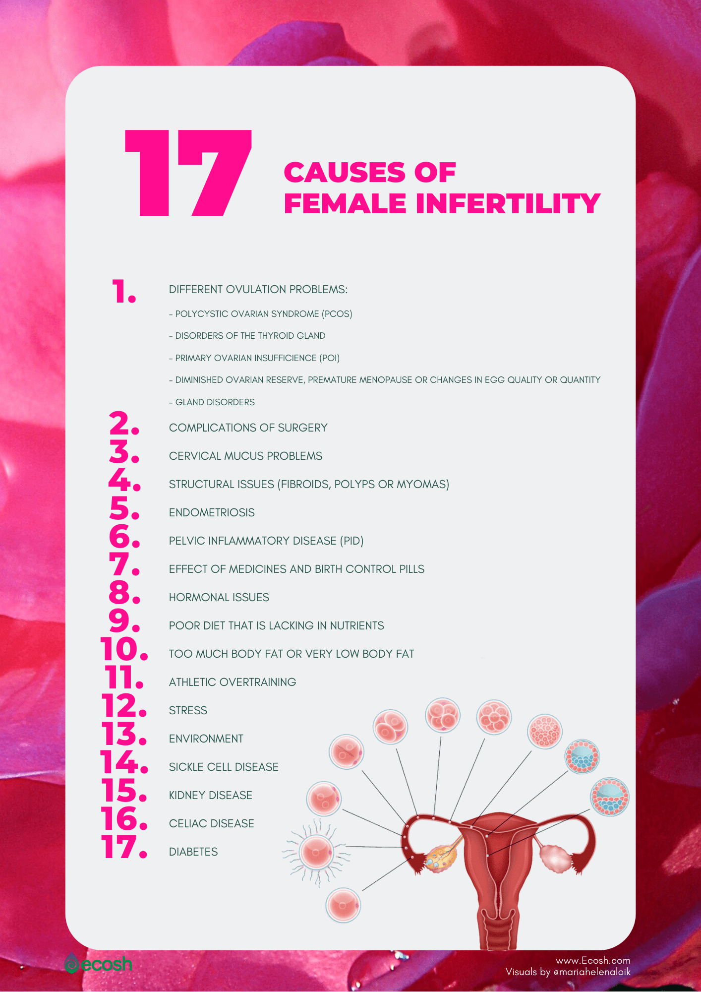 Causes of Female Infertility