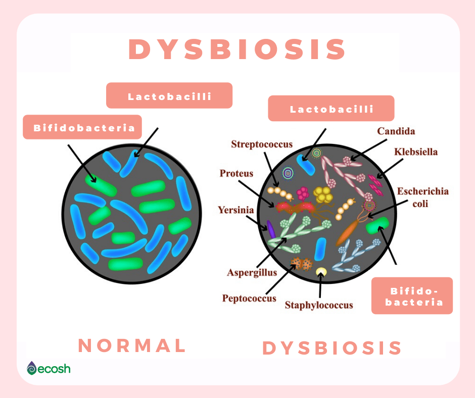 dysbiosis eczema