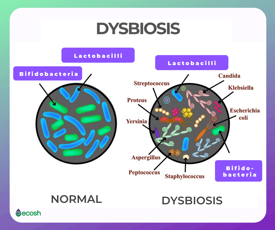 17 Types of Good Bacteria_The List of Most Beneficial Species of Probiotics Lactobacillus and Bifidobacteria_Dysbiosis