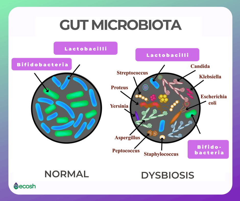 Gut_Microbiota_Healthy_Gut_Microbiota_and_Dysbiosis
