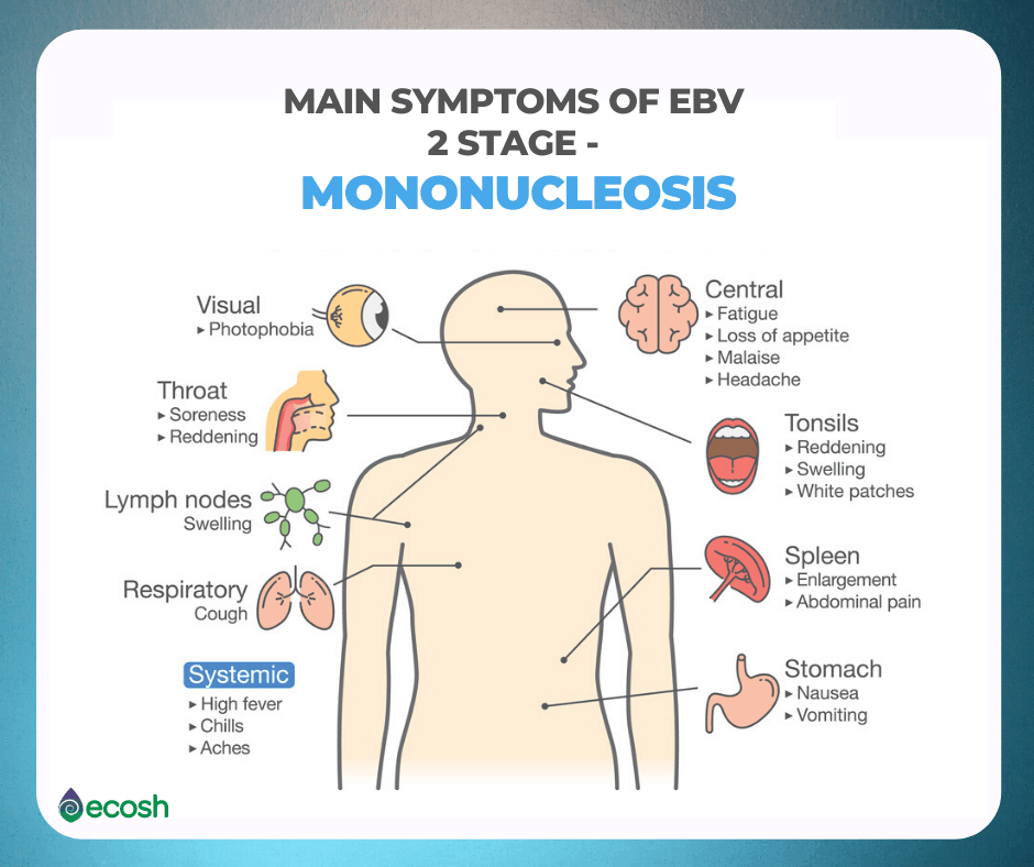 What Is Mononucleosis? Symptoms, Causes, Diagnosis, Treatment, and  Prevention