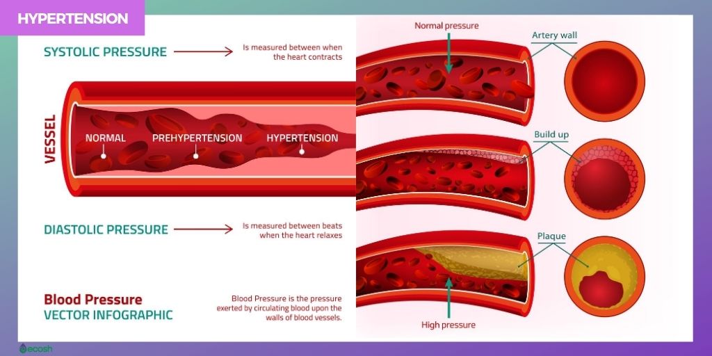 How Low Blood Pressure Is Diagnosed