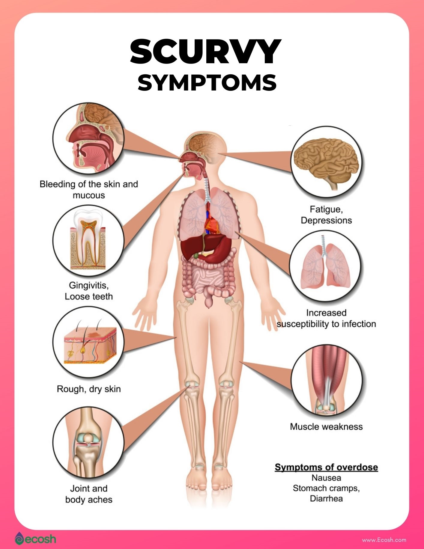 vitamin deficiency rash