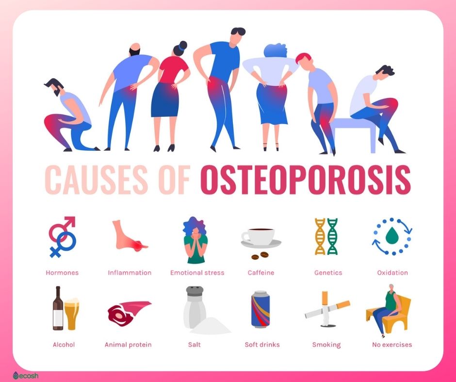 Osteoporosis: Symptoms, Causes and Treatment