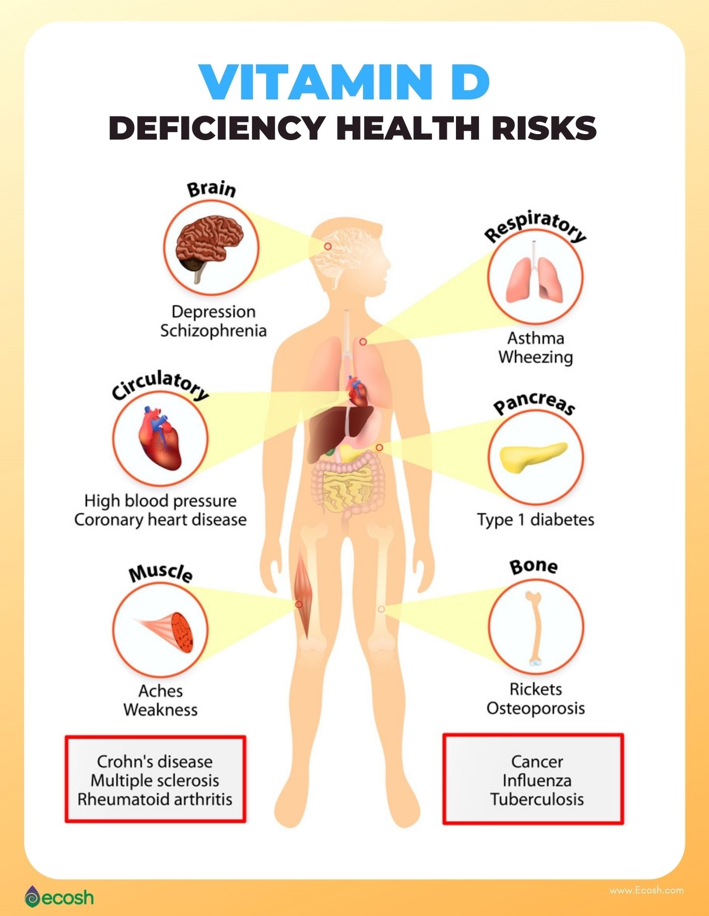 case study of vitamin d deficiency