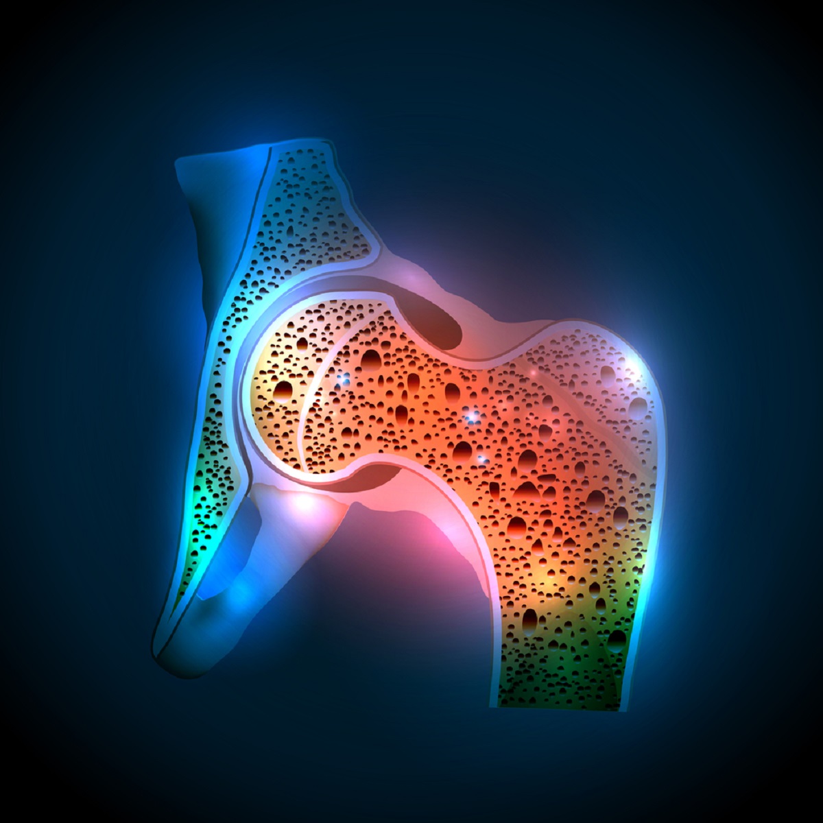 Read more about the article OSTEOPENIA – Symptoms, Causes, Risk Groups, Prevention and Treatment
