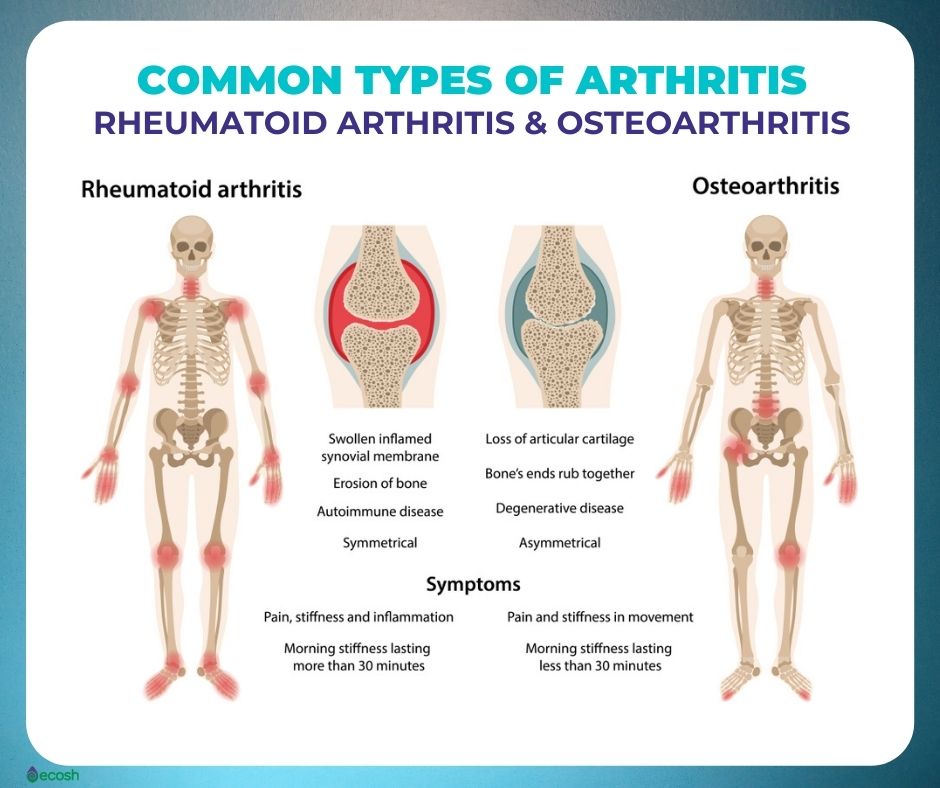 arthritis symptoms and treatments