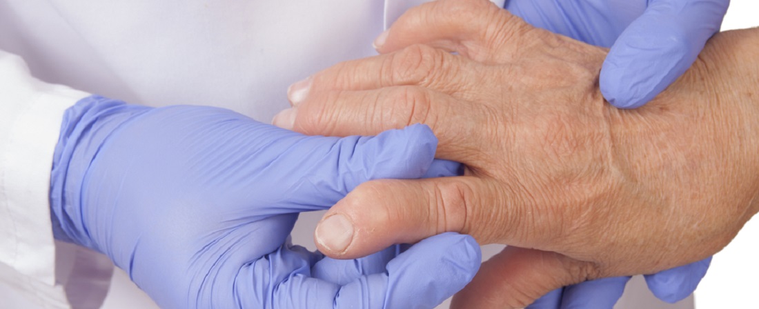 Rheumatoid_Arthritis_Symptoms_and_Signs