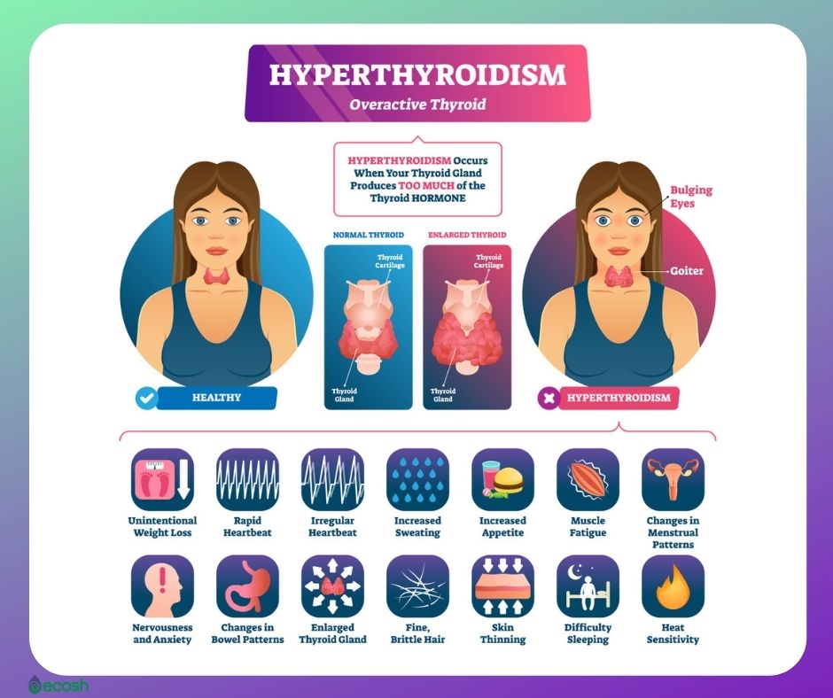 Image result for Managing Graves Disease Symptoms infographics