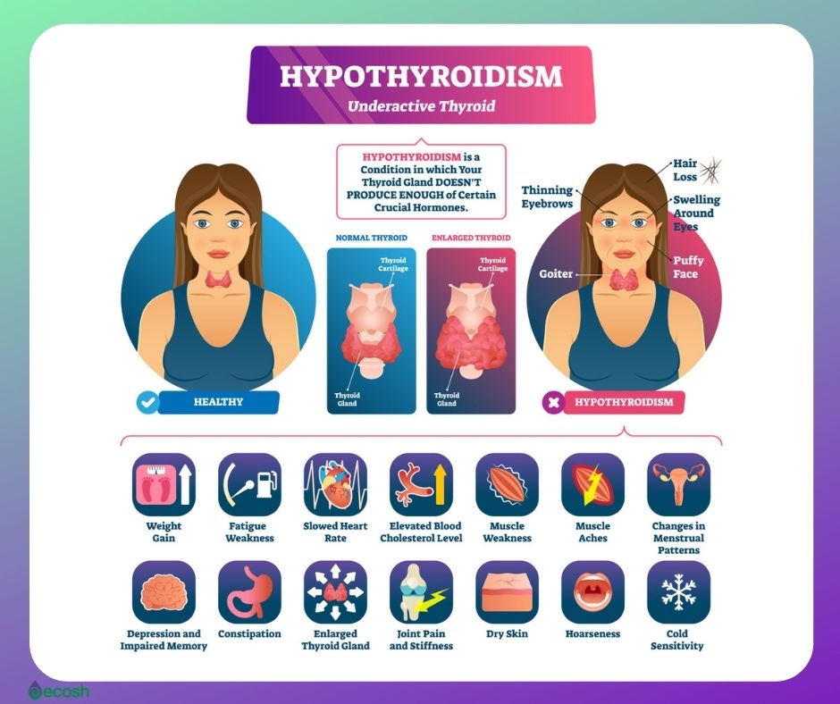 Symptoms thyroid Signs and