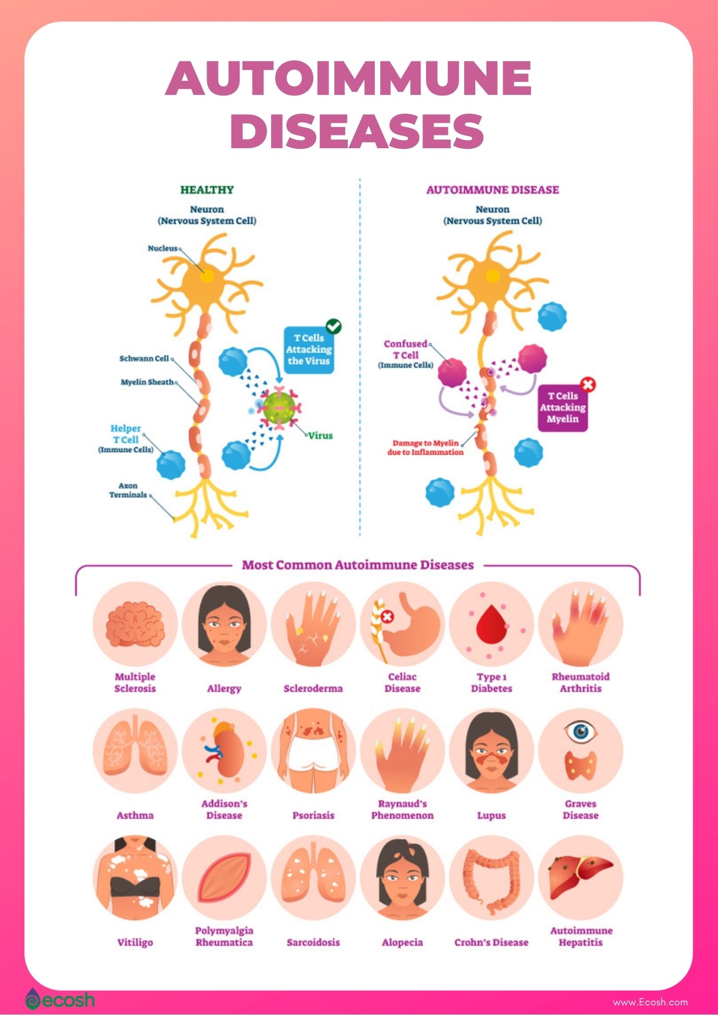 ANXIETY DISORDERS - Symptoms, Causes, Types And Natural Remedies To Relieve  Anxiety Symptoms - Ecosh