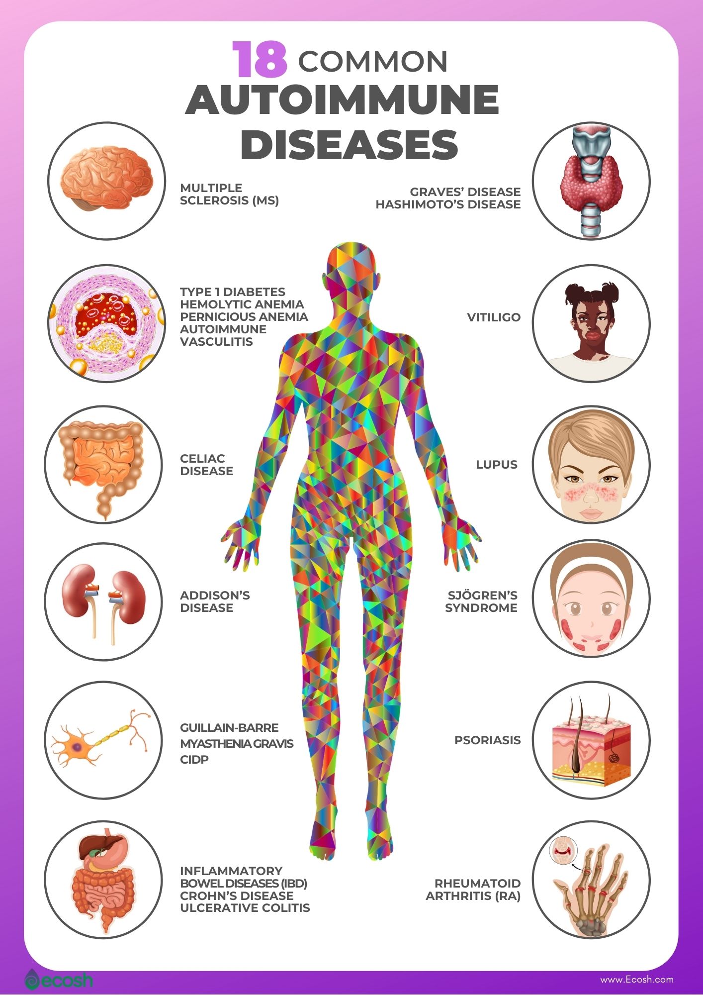 Le malattie autoimmuni Fibromialgia & Diritti