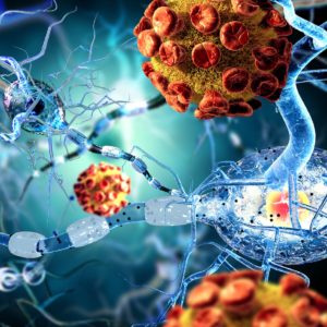 Graves_Disease_Causes_Graves_Disease_Symptoms_Graves_Disease_Treatment
