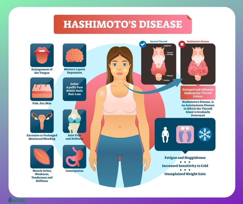 Hashimoto's_thyroiditis_Symptoms_Hashimoto's_thyroiditis_Signs_Hashimoto's_disease_Signs_and_Symptoms (2)