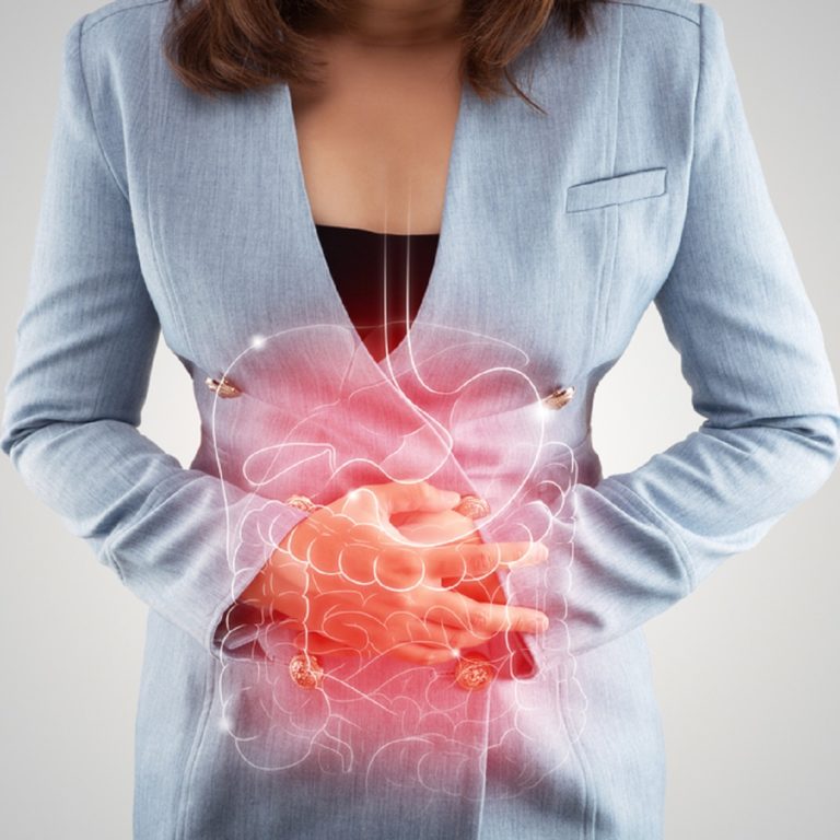 CROHN’S DISEASE – Symptoms, Causes, Risk Factors, Crohn’s Disease Diet and Supplements for Crohn’s Disease Treatment