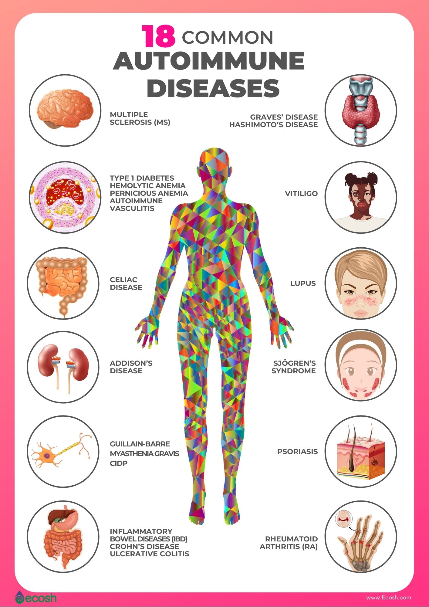 ulcerative colitis symptoms