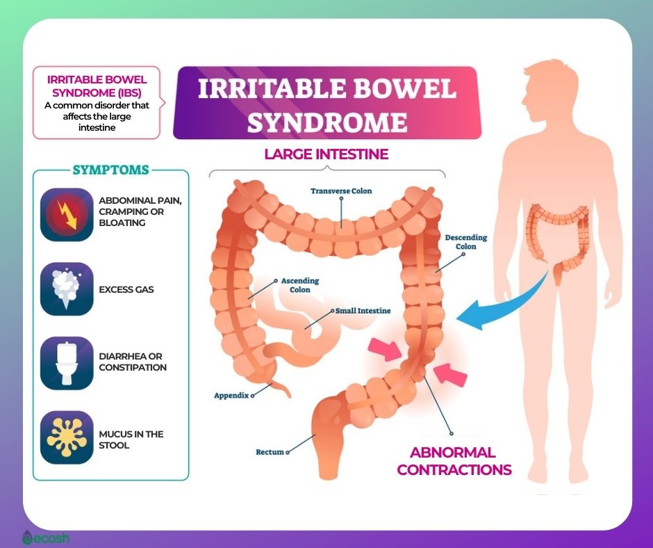 irritable bowel syndrome bloating