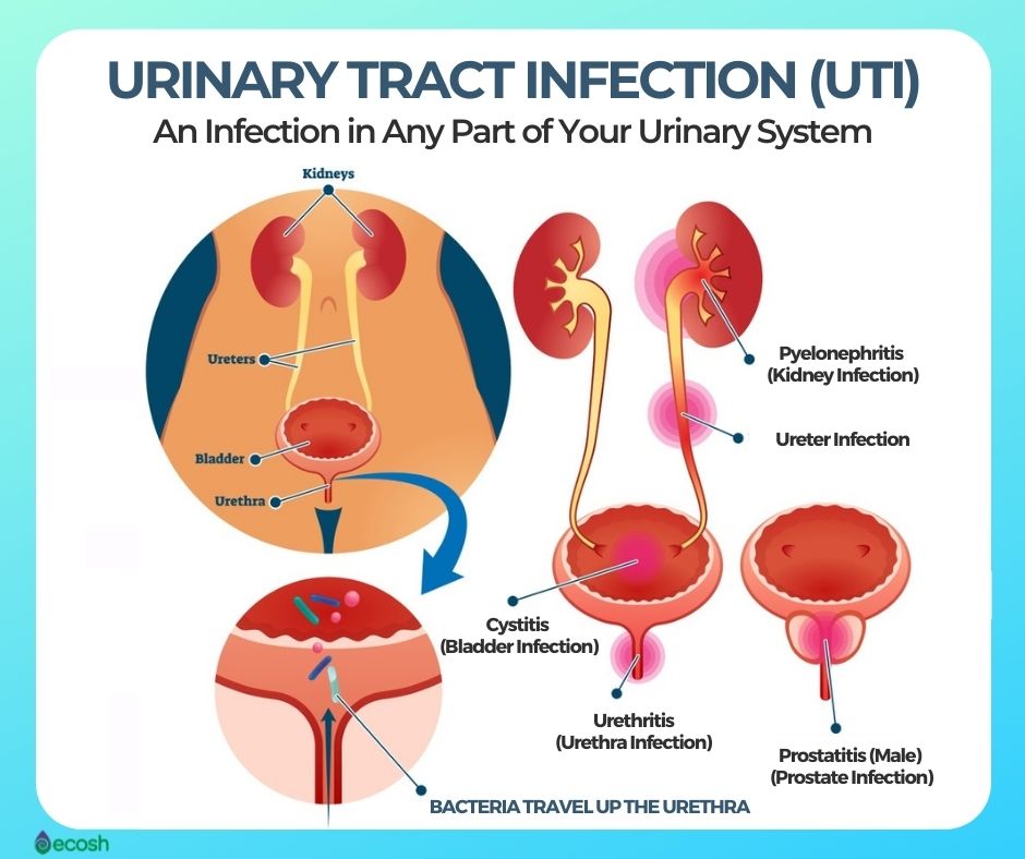 UTI in Pregnancy: Prevalence, Symptoms, Causes, and Treatments