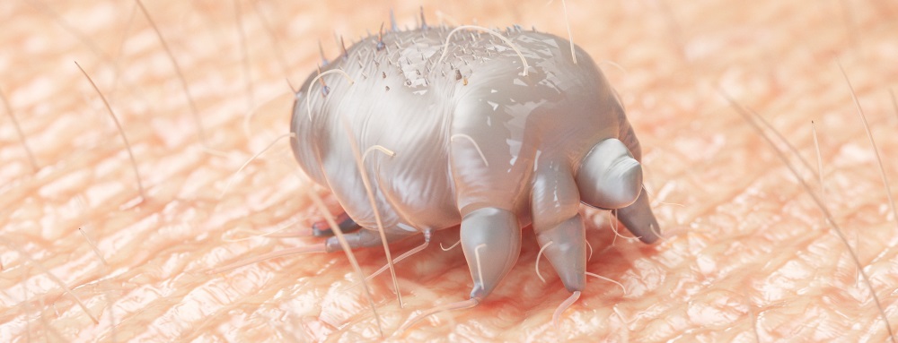 Ectoparasites Scabies