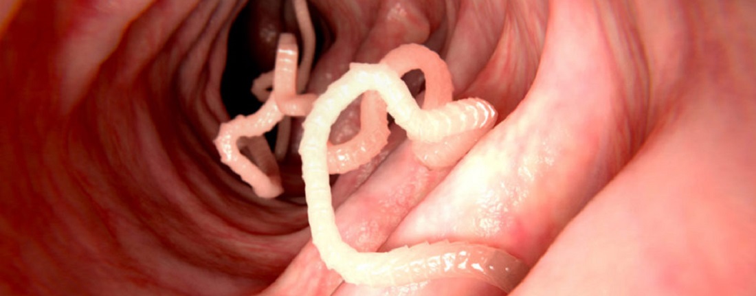 Tapeworm